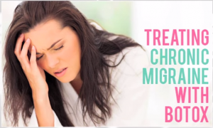 botox migraine treatment