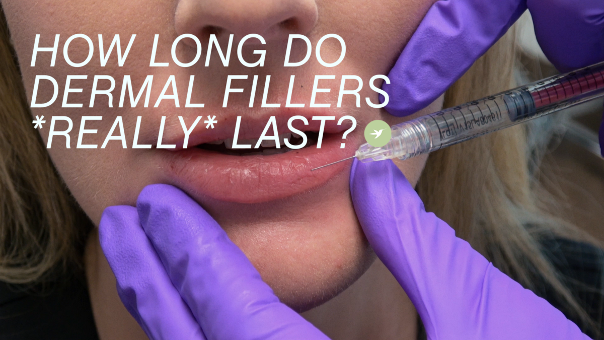 How Long Do Dermal Fillers Last? Skin by Lovely
