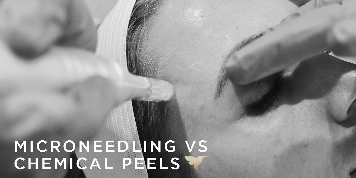 Microneedling vs. Chemical Peels Skin by Lovely