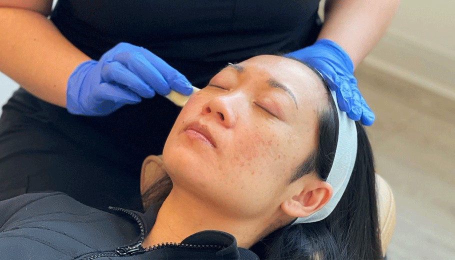 Chemical peels pre and post care instructions