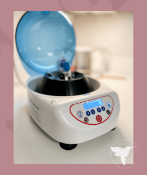 Skin by Lovely PRF Treatment Centrifuge