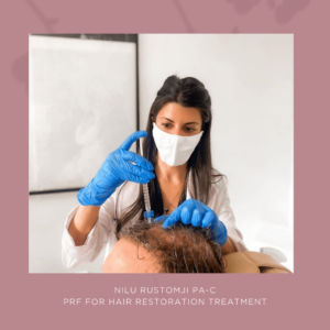 Hair PRF PRP Treatment in Santa Monica