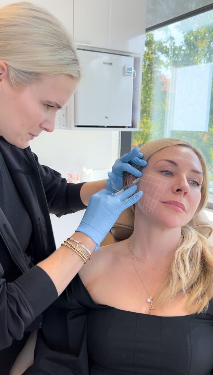 SkinVive Treatment with Lovely Laban Portland Oregon