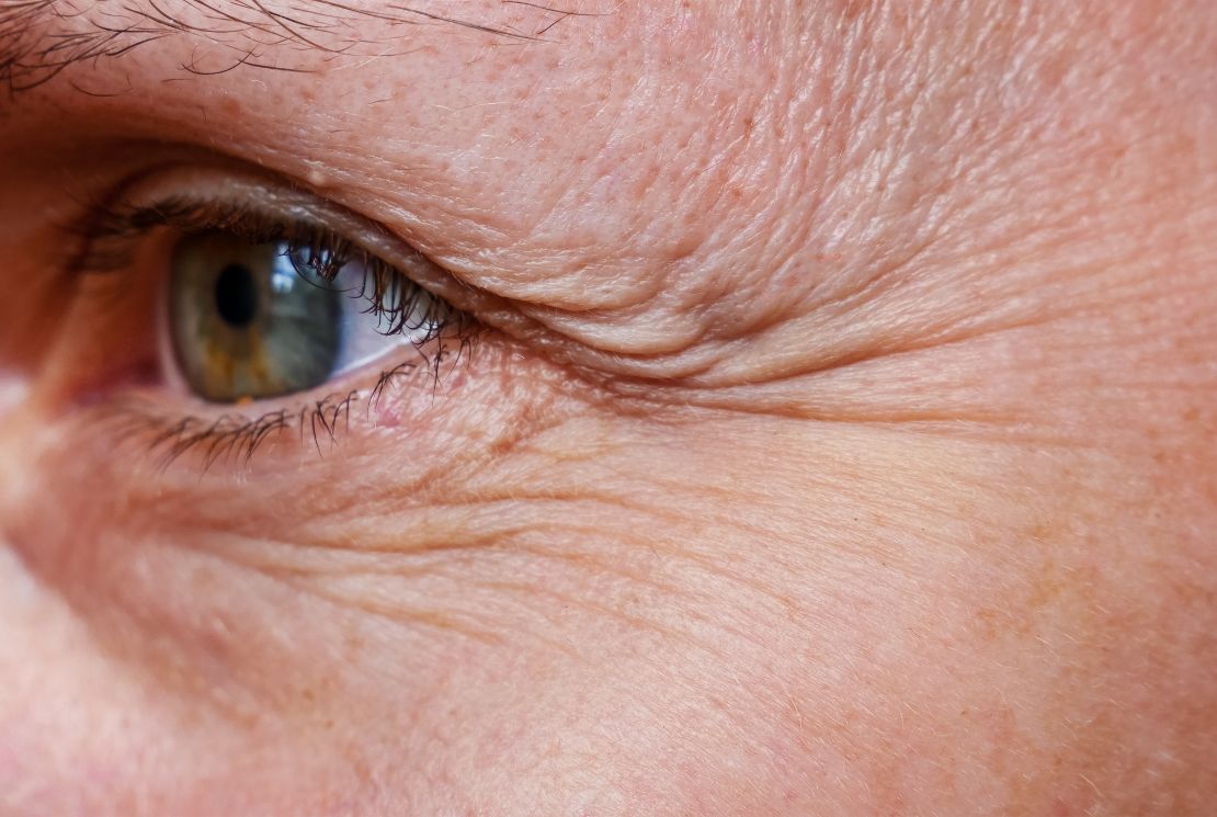 The Science Behind Wrinkles and How They Develop