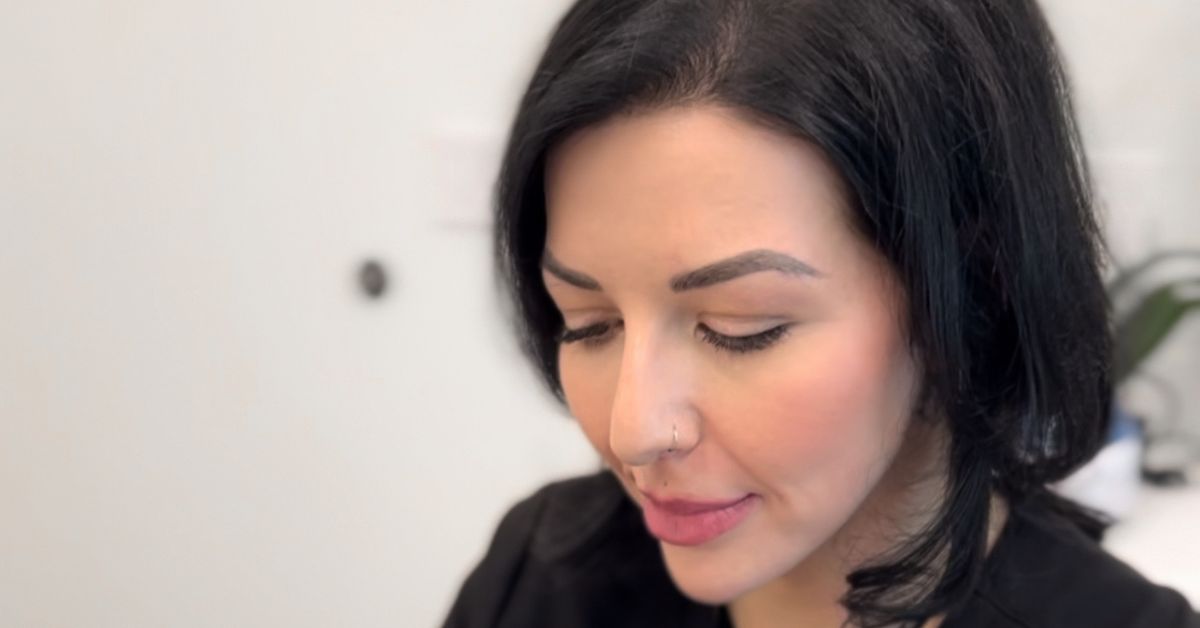 What are bunny lines and what can you do for them? 