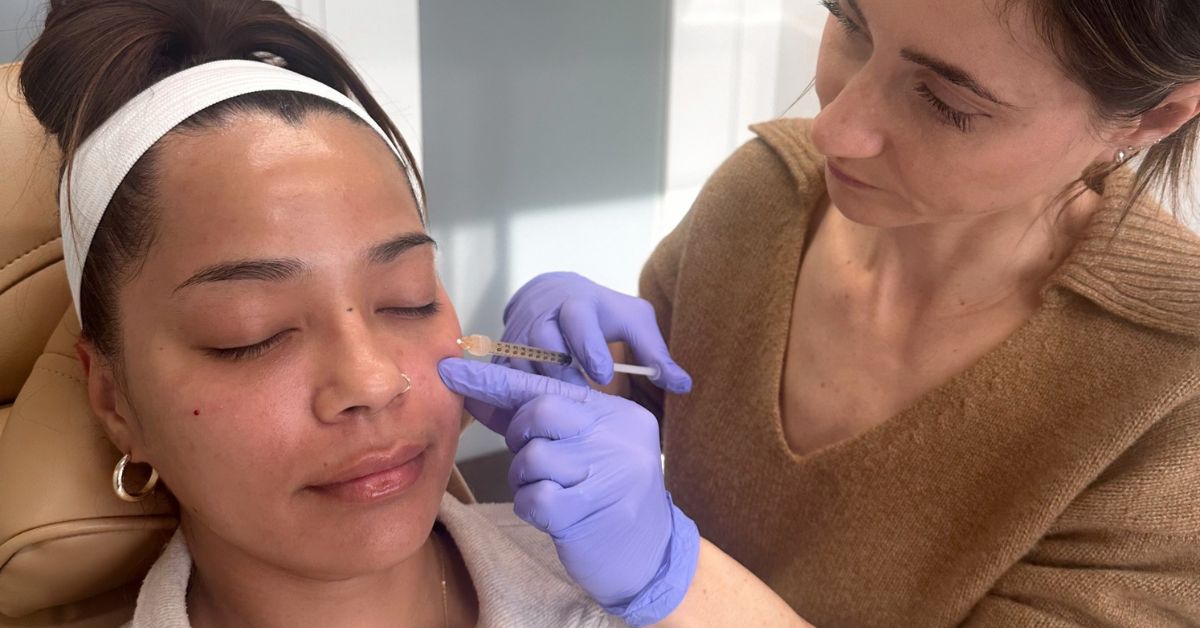 11 Important facts for Botox Botox hood 