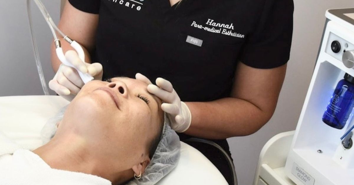 Microneedling Benefits: Glow in 1 Session 
