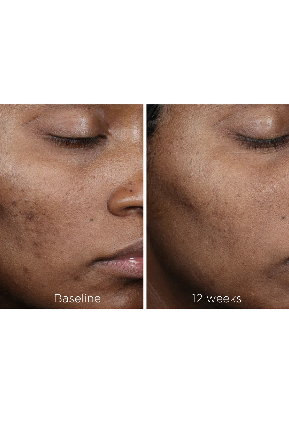 Complexion Brightening Serum