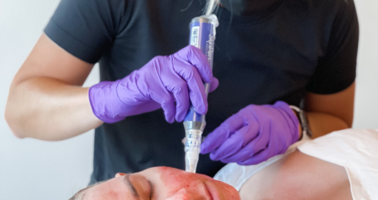 Pre & Post Microneedling care